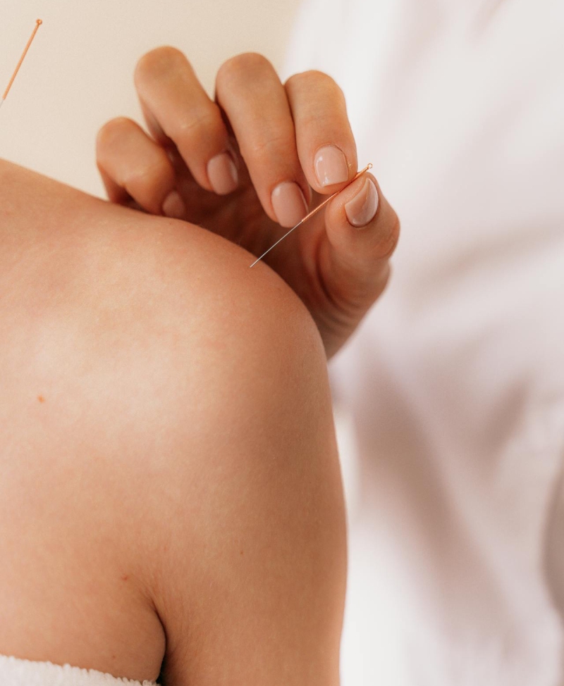 Dry Needling Cortez, CO